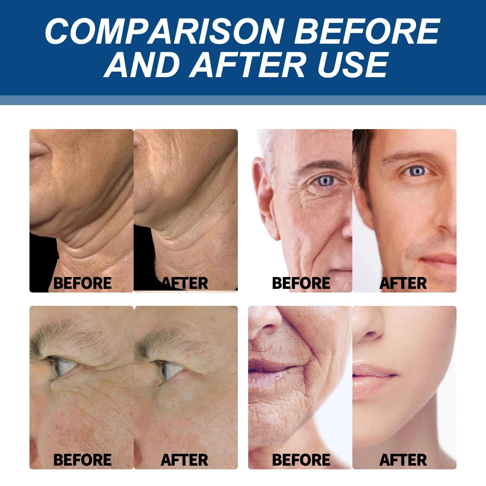 Men's Facial Fade Acne Marks, Cleanses, Gentle Hydrating Moisturizing Anti-Wrinkle Collagen Cream